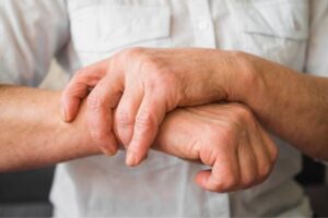 Rheumatoid Arthritis